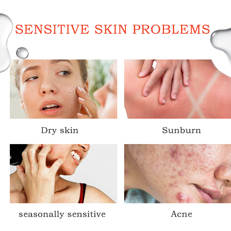 Anti-Aging Acne Reduce Face Redness Smoothing Skin Hydrating Facial Toner Spray