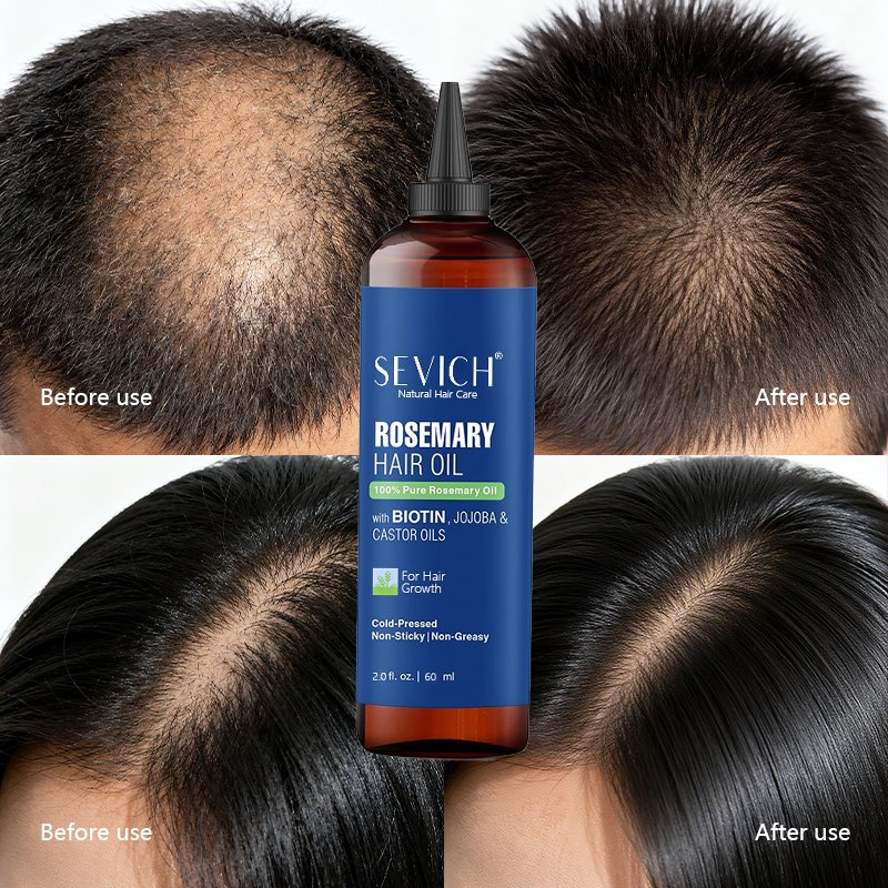 Factory Wholesale Natural Herbal Rosemary Biotin Hair Essential Oil 60ml Repair Hair Growth Serum Oil