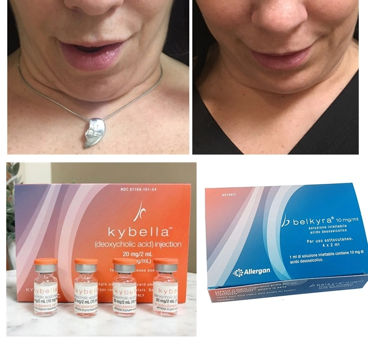 Phosphatidylcholine Lipolytic Enzymes Lipolytic Mesotherapy Solution 10vails*10ml Ppc Body Slimming /Lipolytic Solution for Weight Losskybella Aqualyx