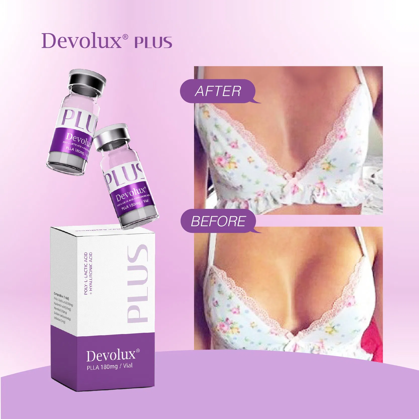 Devolux Plus 180mg/Vial Plla for Buttock Breast Enlargement and Body Shaping Injection