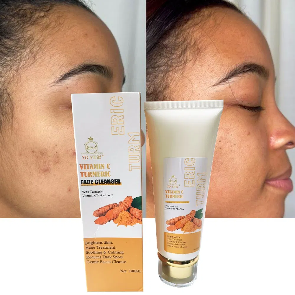 Skin Care Turmeric Gel Face Wash Facial Cleanser OEM/ODM Foam Fast Effective Acne Remover Turmeric Face Cleanser