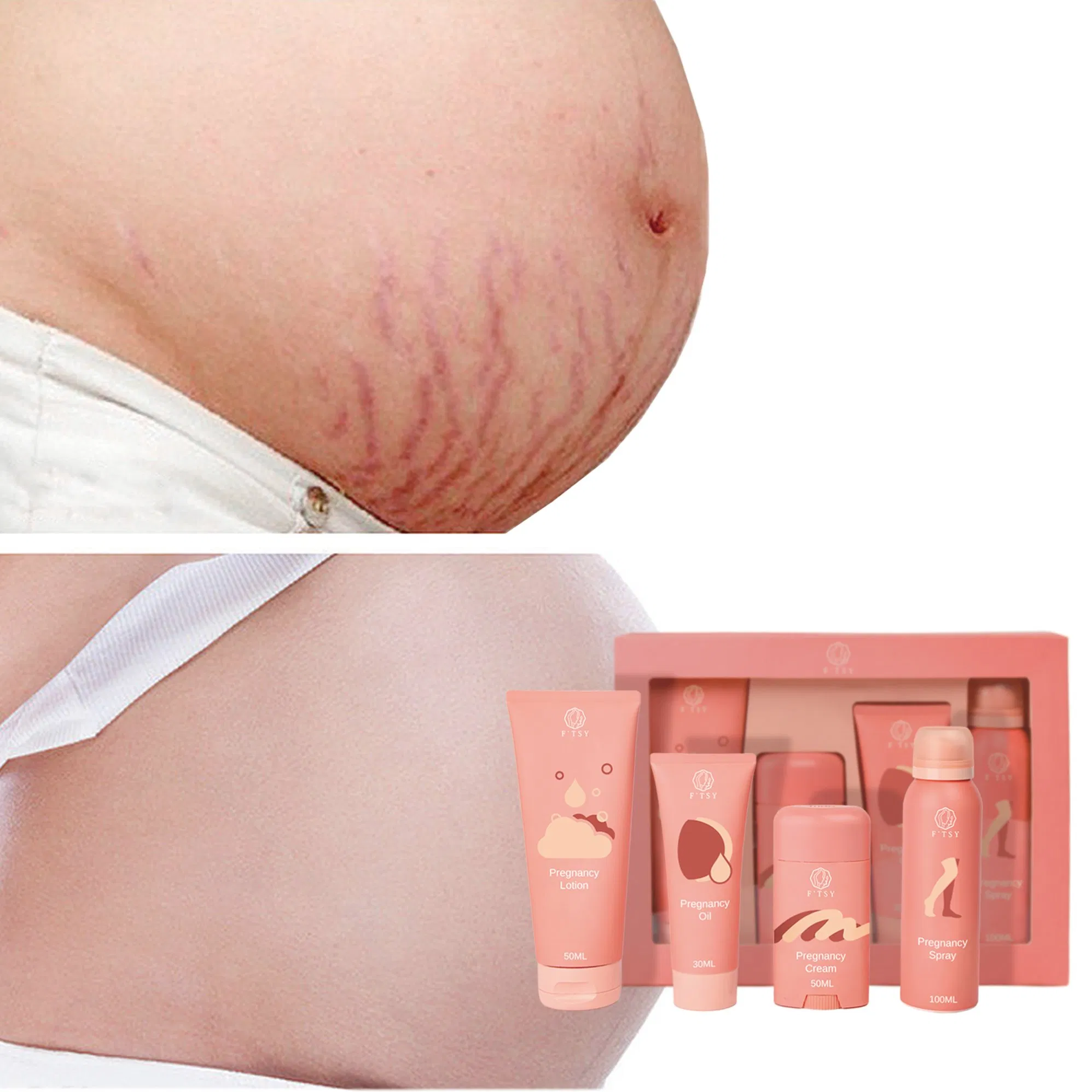 Directly Factory Natural Organic Pregnancy Must-Haves Body Care Sets Soften and Smooth Skin Remove Stretch Marks Pregnancy Gift Set