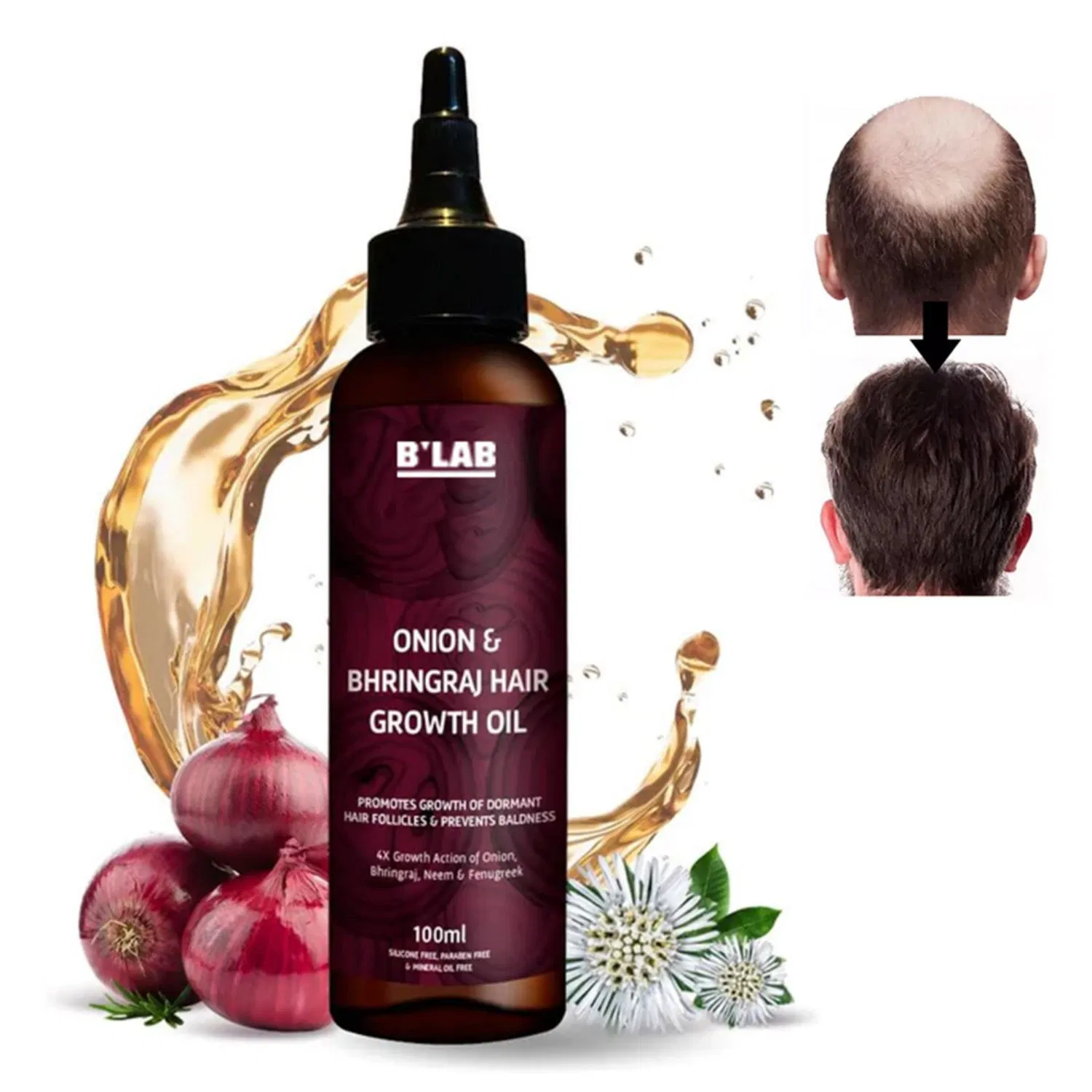 Wholesale Organic Natural OEM Hair Growth Oil for Hair Regrowth Growth