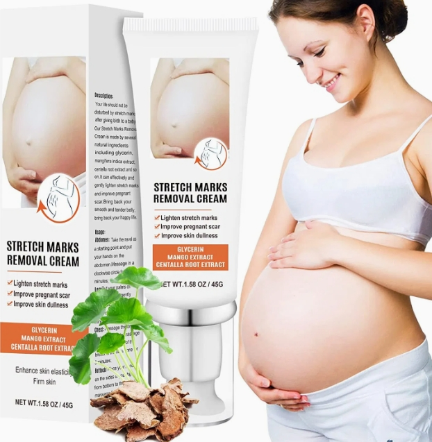 Beauty Cosmetics Skin Care Stretch Marks Removal Improve Skin Dullness Repair Stretch Mark Remover Cream