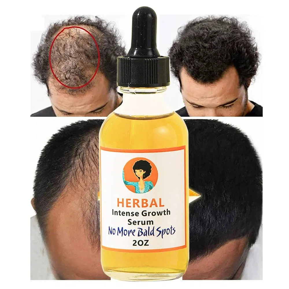 Nutritional Hair Growth Oil Serum Scalp Care Liquid Essence for Hair Care