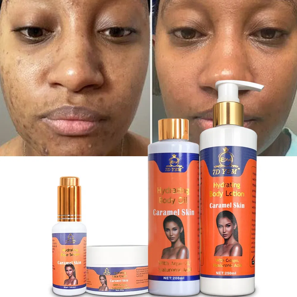 OEM Whitening Anti Acne Smooth Skin Care Sets Carotene Hydrating Brightening Skin Set for Caramel Skin
