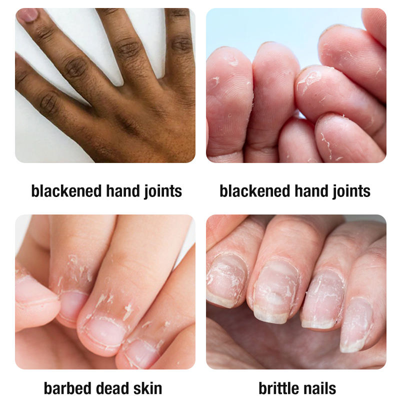 Private Label Skin Care Products Moisturizing Exfoliating Rose Essence Hand Mask Hydrating Peeling Gloves Sheet Hand Mask