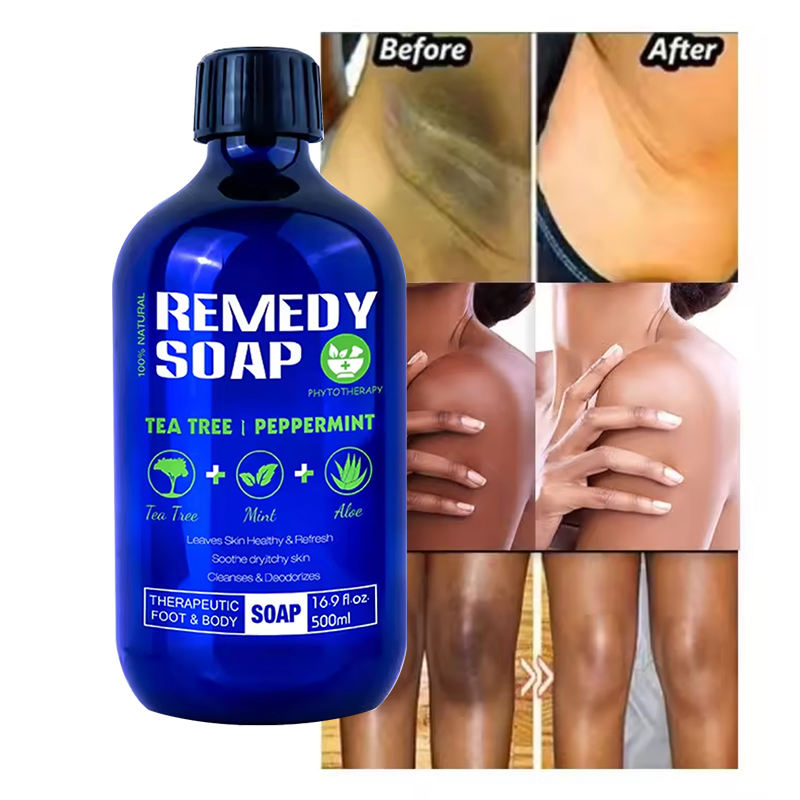 Private Label Natural Organic Body Wash Healing Cleansing Soap Tea Tree Oil Nourishing OEM Shower Gel for Soothes Itchy Skin