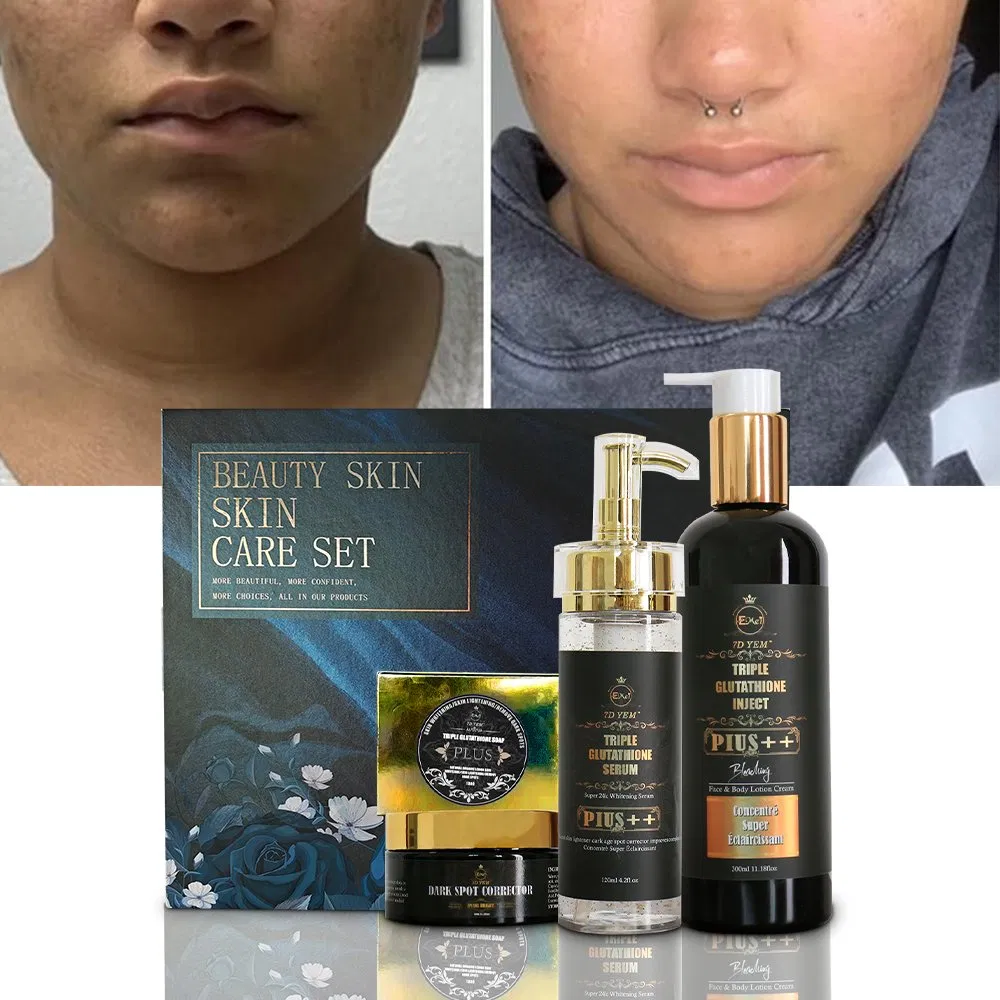 Glutathione Collagen Whitening Skin Care Set Strong Effective Anti Acne Dark Spot Cream Serum Oil Set Brightening Skin Care Set