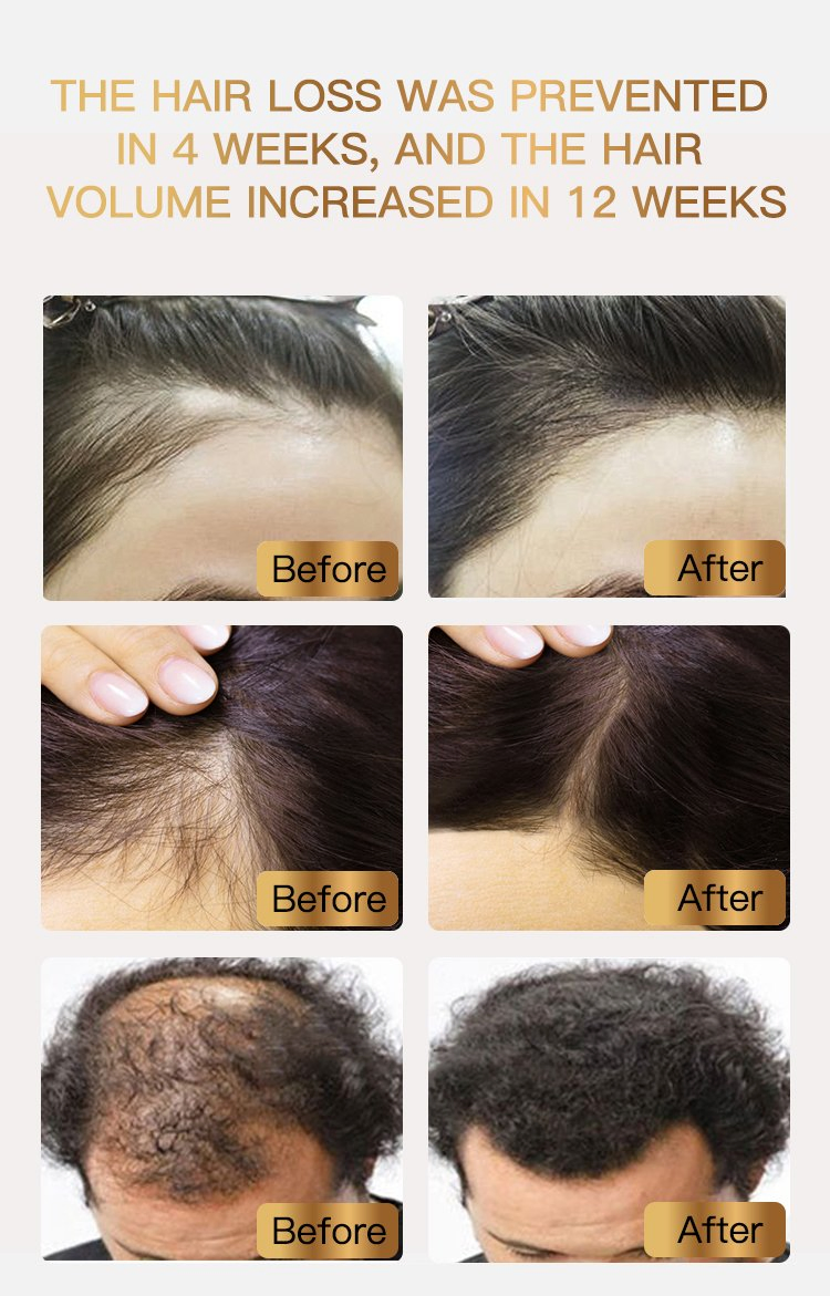 OEM Factory Wholesale Anti Loss Hair Serum Thick Enhancer Oil for Men Hair Growth Oil