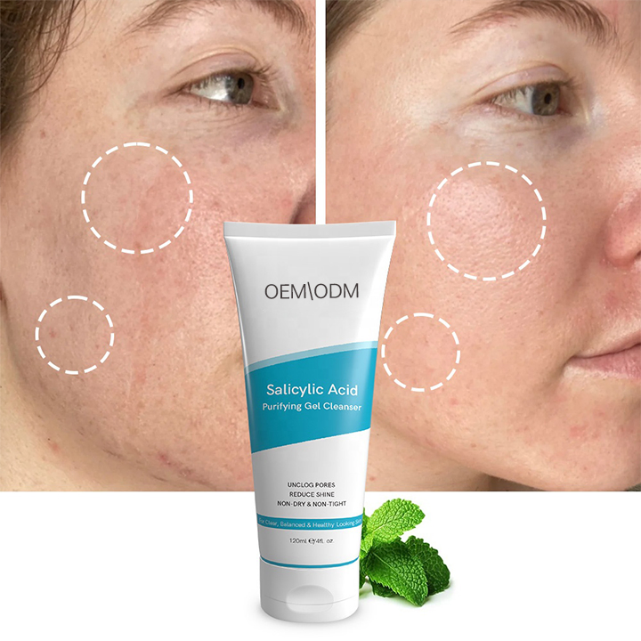 Salicylic Acid Gel Cleanser Unclogs Pores, Reduces Shine, Non-Dry Non-Tight Facial Cleanser