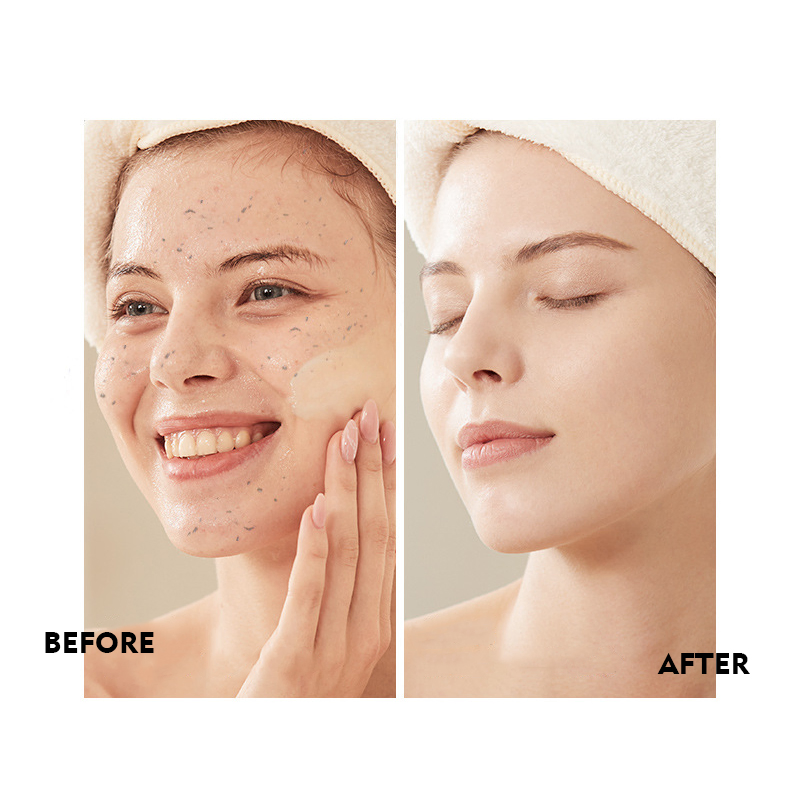 Nourishing Exfoliating Face Gel Peeling Cleansing Gel Whitening for All Skin
