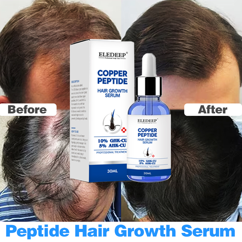 B Blue Copper Peptide Scalp Nutrient Solution Hair Strengthening Serum with Follicle Activation Scalp Repair Anti-Inflammation