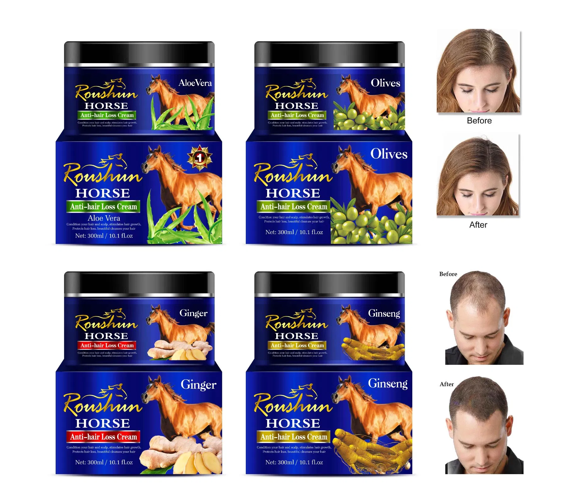 Roushun Horse Anti-Hair Loss Treatment Aloe Vera