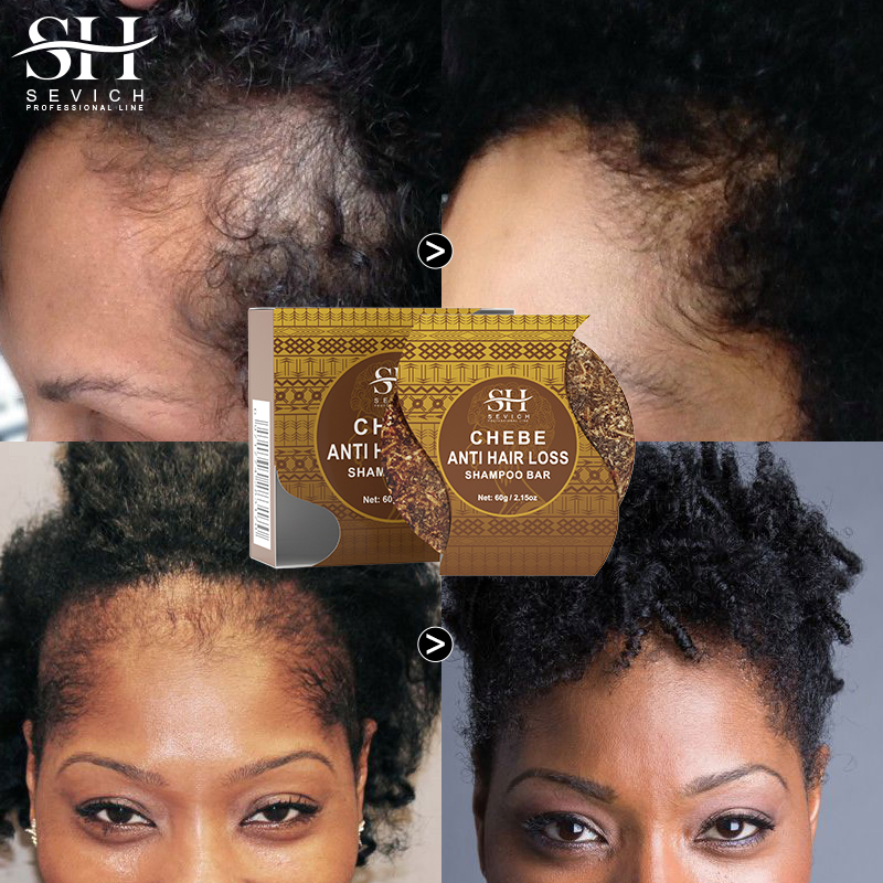 Chebe Shampoo Bar for Hair Regrowth African Crazy Traction Alopecia Anti