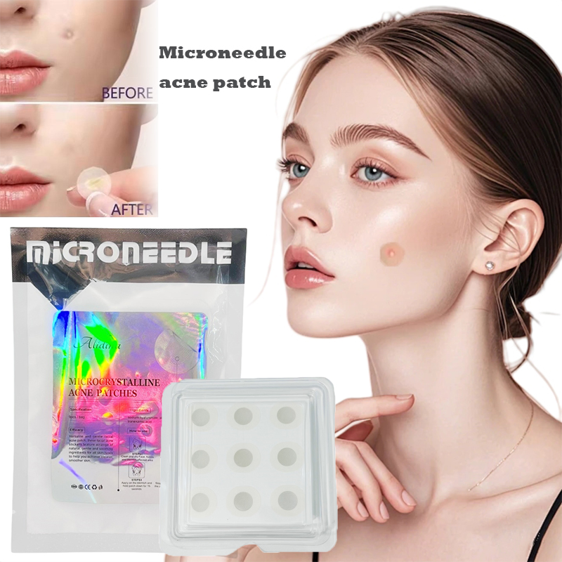 OEM White Microneedles Anti Aging Eye Patch Round Acne Pimple Patch Dissolved Micro Needle Acne Dark Spot Removal Patch