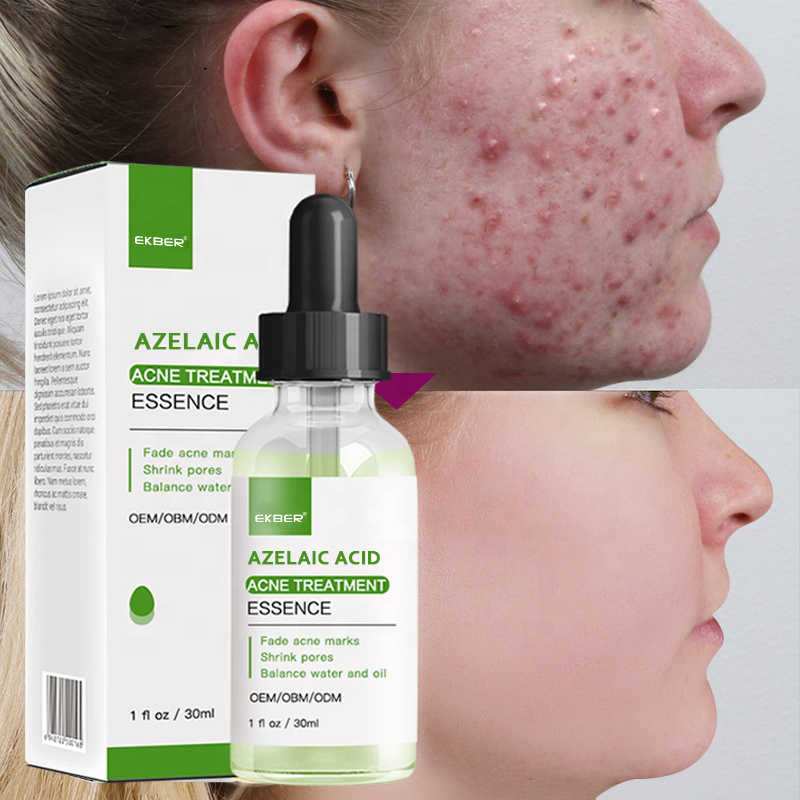 Hot Selling Ekber 30ml Azelaic Acid 15% Facial Serum with Centella Black Head Remover Face Care Azelaic Acid Serum