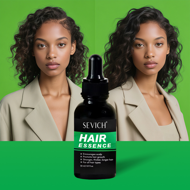 New Arrival OEM Herbal Ginger Ginseng Anti Hair Loss Treatment Scalp Care Hair Growth Essential Oil