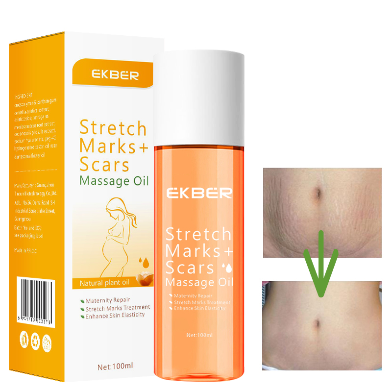 High Quality Mothers Special Blend Remove Pregnancy Scars Stretch Mark Removal Oil with Vitamin E Natural Argan Oil