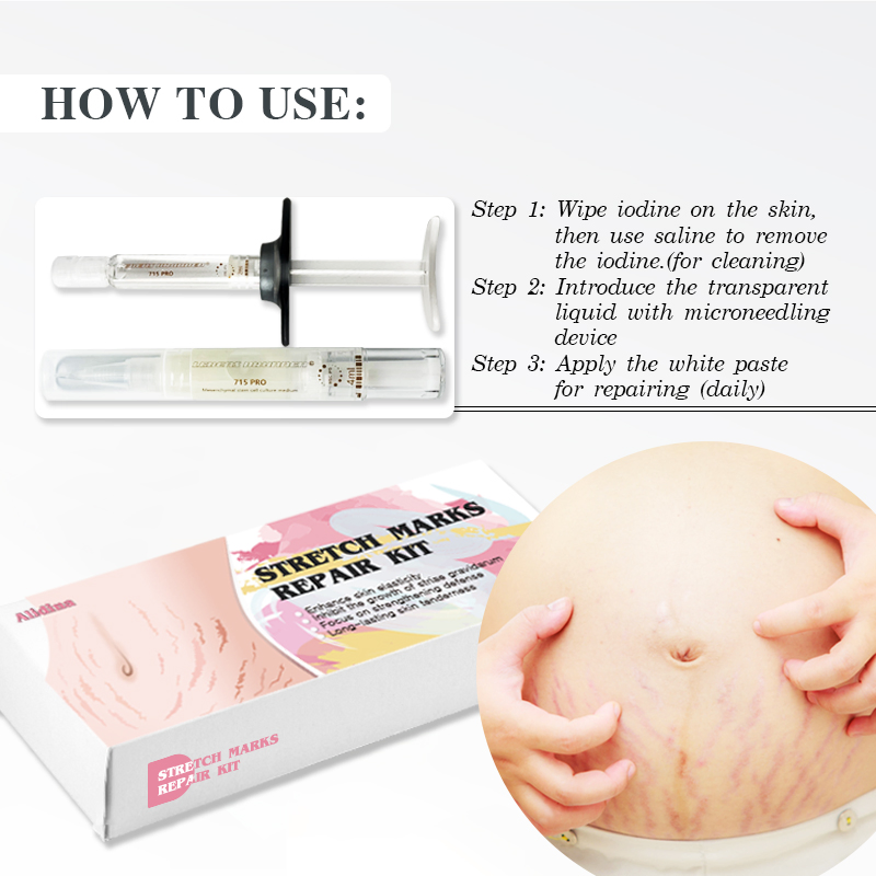 Stretch Marks Permanent Reduce Cream Eliminate Body Belly Stretch Marks Swelling Marks Reduce Skin Cracks Repair Firming Care