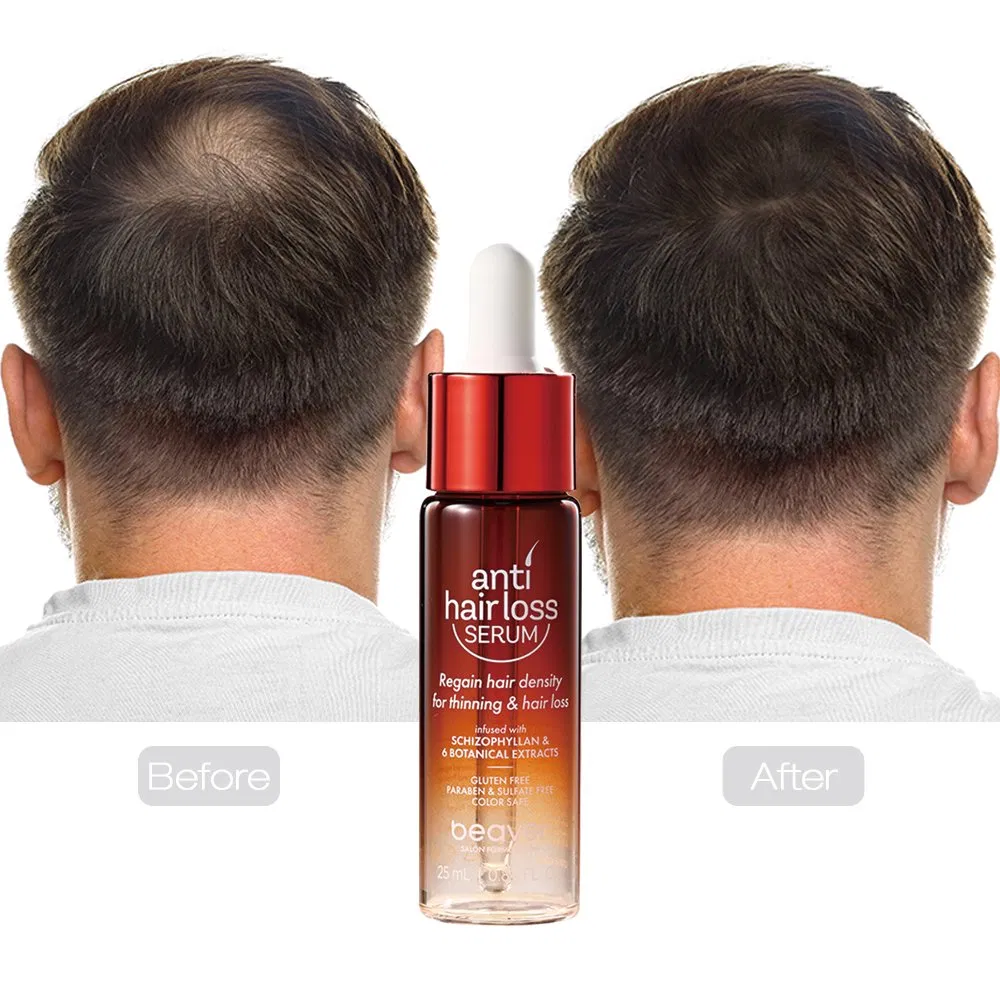 Beaver Herbal Scalp Hair Growth Oil Ginger Anti Hair Loss Serum