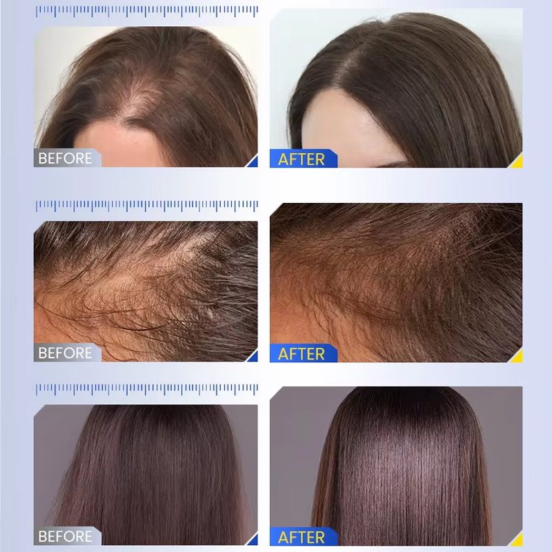 Ditong Growth Serum Roll-on Massager Hair Thicken Rosemary Refreshing Help Hair Growth Leave in Essence for Scalp&Hair