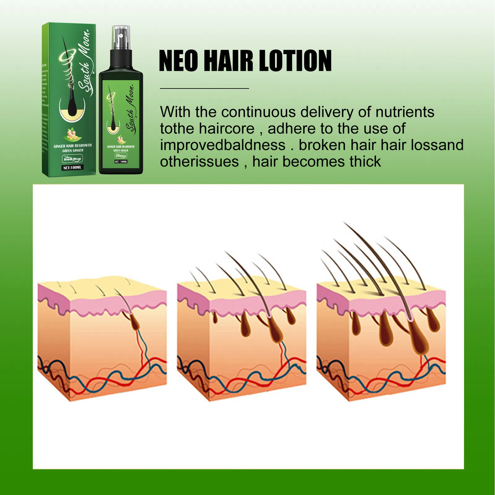 2024 Hair Growth Serum Private Label Ginger Hair Regrowth Redensyl Hair Growth Serum