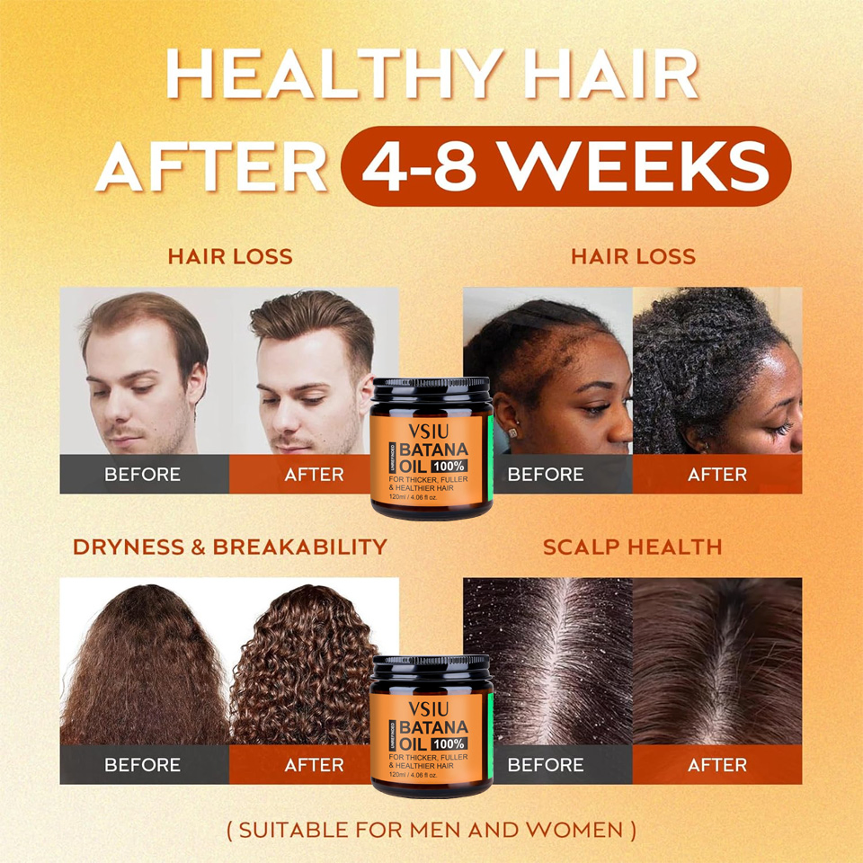 Botanic Hearth Hair Oil for Hair Growth Strengthening Dry Frizzy Damaged Hair & Scalp Treatment No Parabens No Harmful Sulfates