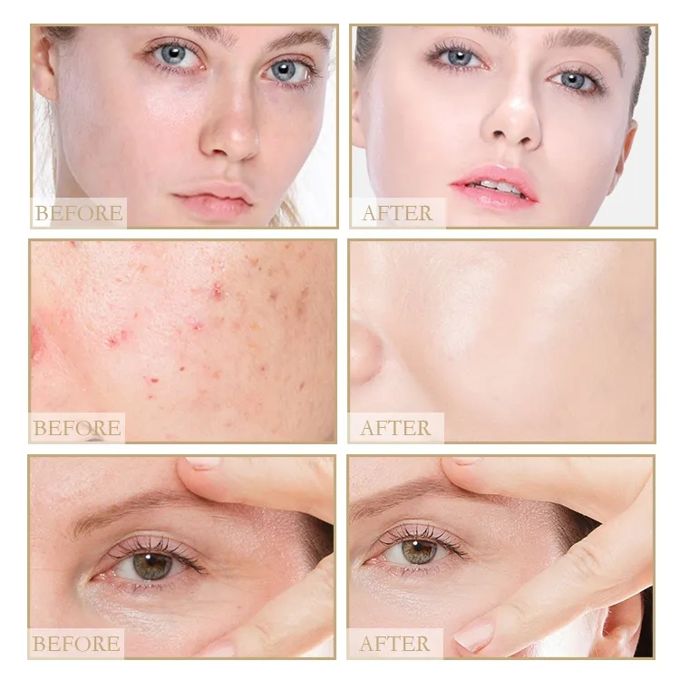 Beauty Cosmetics Skin Care Hydrate and Brighten The Skin Rice Skin Care Set