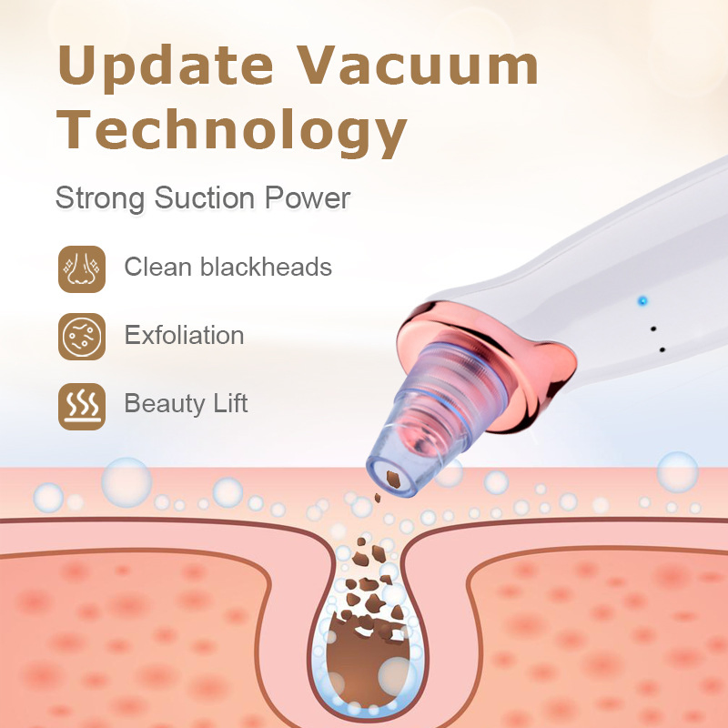Professional Pore Cleaning Device for Ultimate Beauty Care