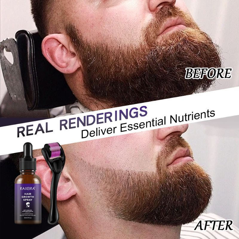 Hot Selling OEM ODM Custom Logo Organic Wholesale Anti-Loss Hair Growth Spray for Men