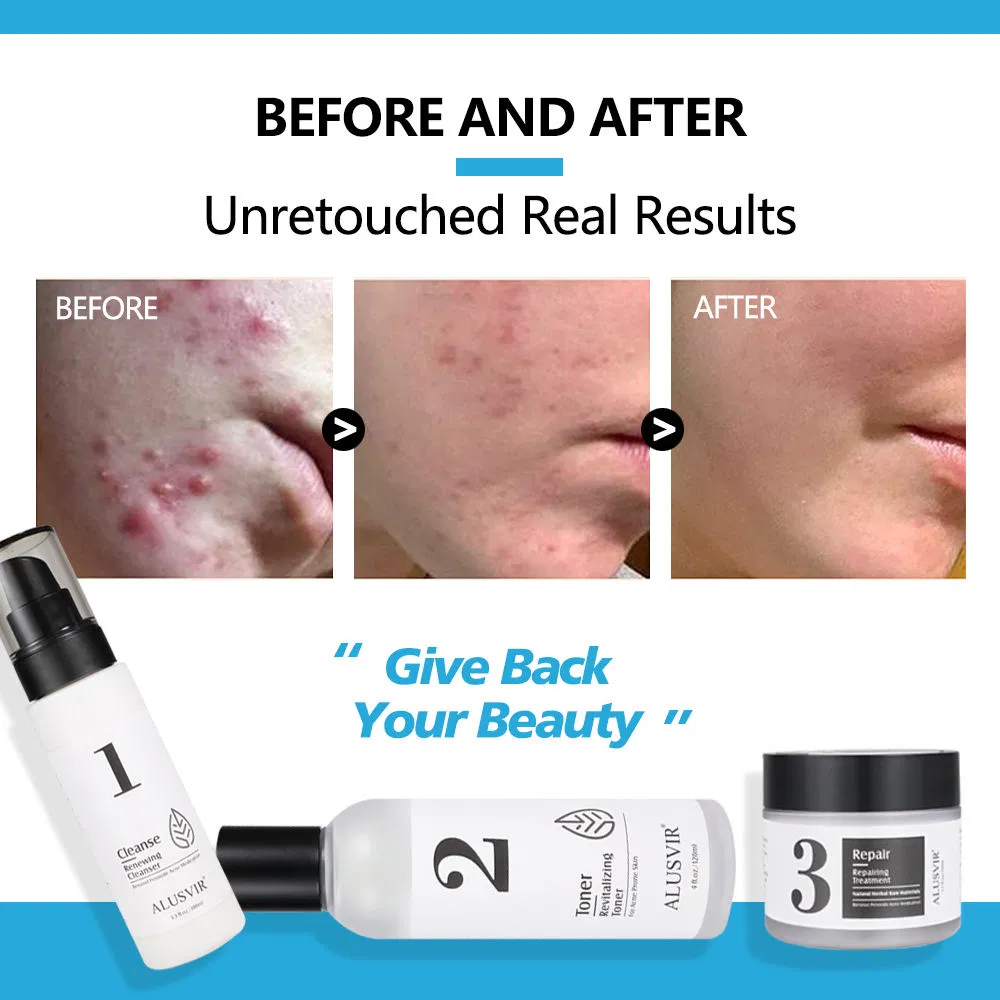 Vegan Natural Moisturizing Oil Control Facial Soothing Anti Acne Treatment Face Toner