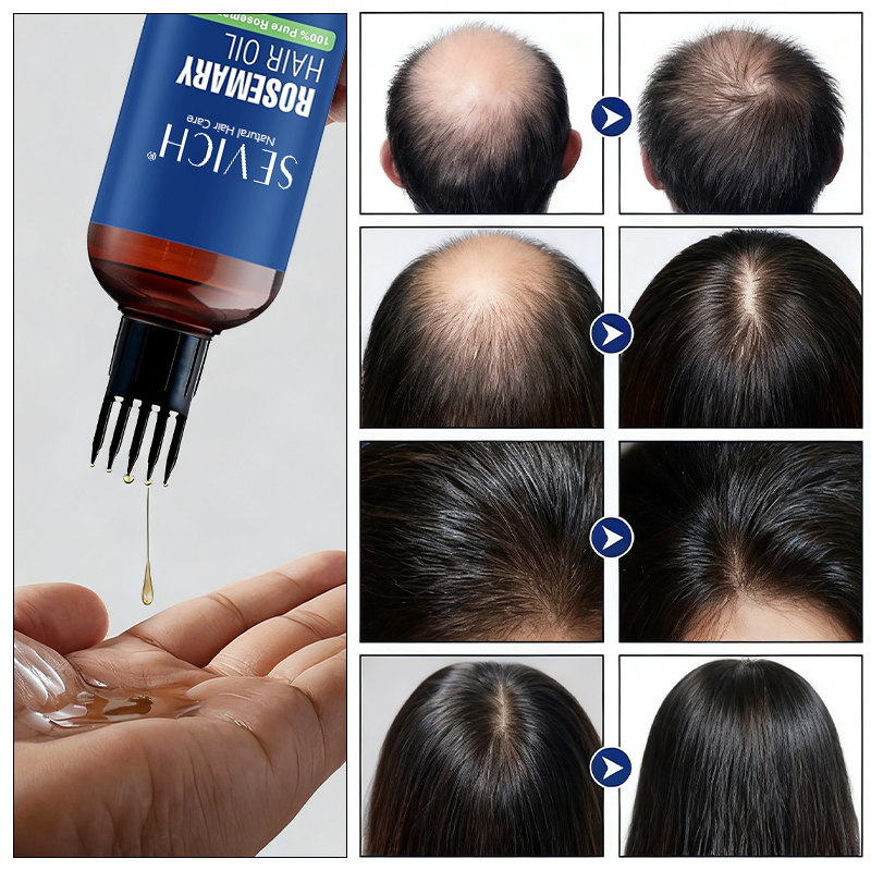 Factory Wholesale Natural Herbal Rosemary Biotin Hair Essential Oil 60ml Repair Hair Growth Serum Oil