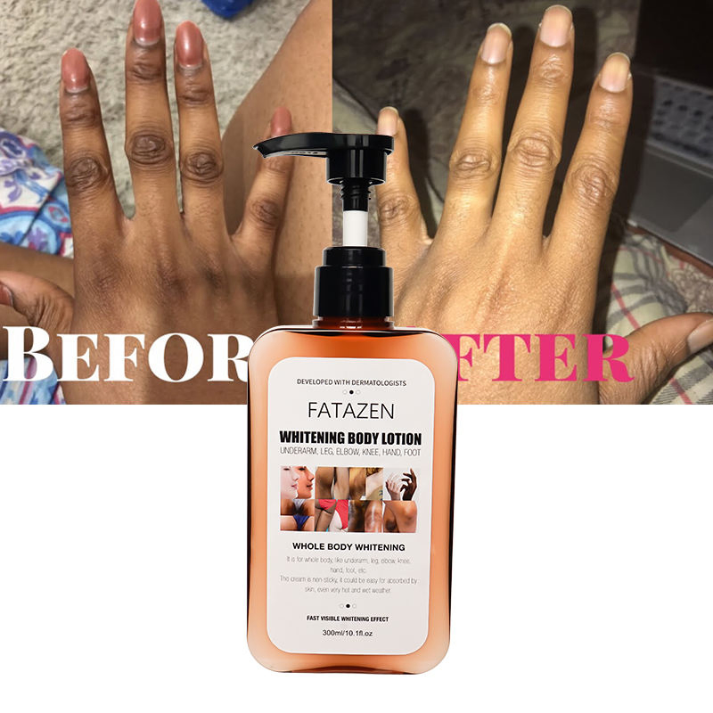 Fatzenskin Care Products Organic Arbutin Skin Whitening Exfoliating Cream Anti Dark Spot Moisturizing Whitening Body Lotion