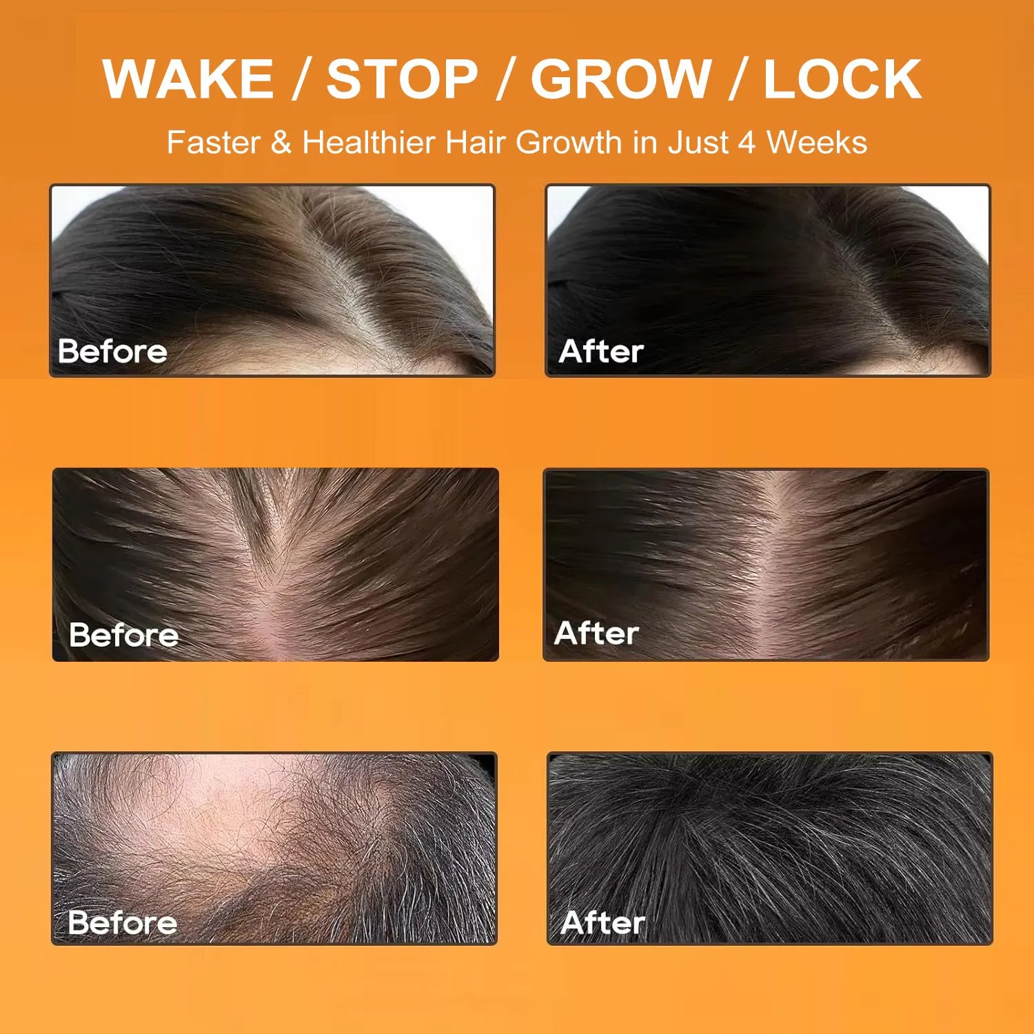 Organic Herbal Hair Growth Essence Serum Dry Hair Care Nourishing Essential Oil for Hair Treatment