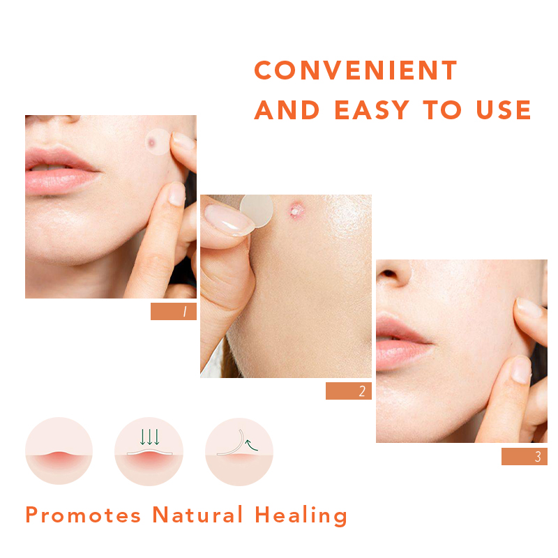 Customized Private Label Moisturizing Hyaluronic Acid Anti-Aging Micro Needling Eye Patch Eye Mask for Skin Care