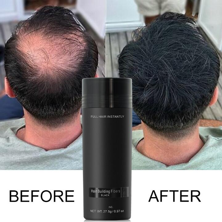 Customized Private Label Hair Loss Treatment Fully 2ND Generation Hair Building Fibers