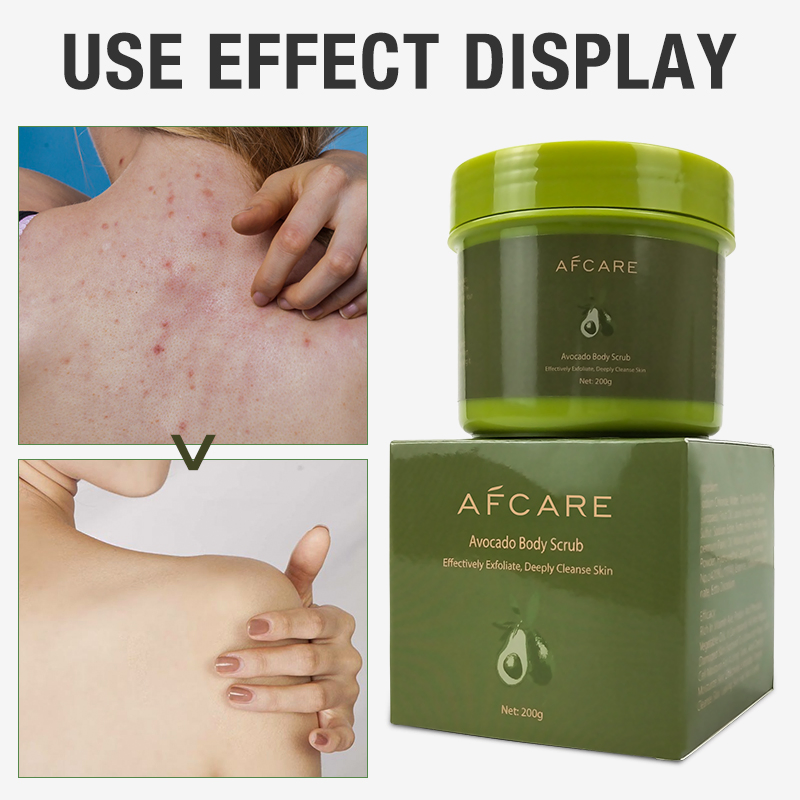 Private Label Body Care Avocado Body Scrub OEM/ODM Whitening Moisturizing The Skin