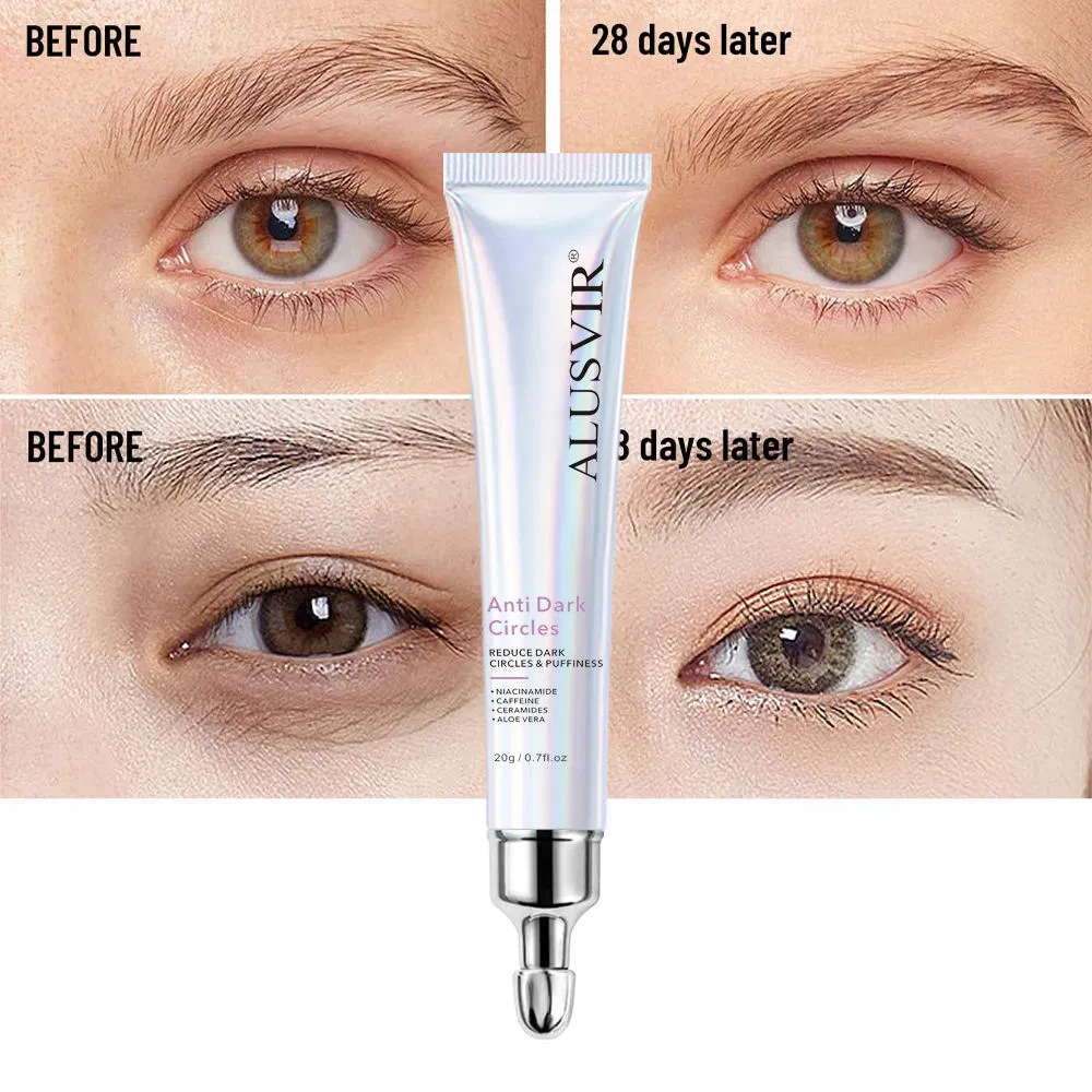 Niacinamide Dark Under Eye Circles Repair Anti Wrinkle Eye Bags Removal Cream