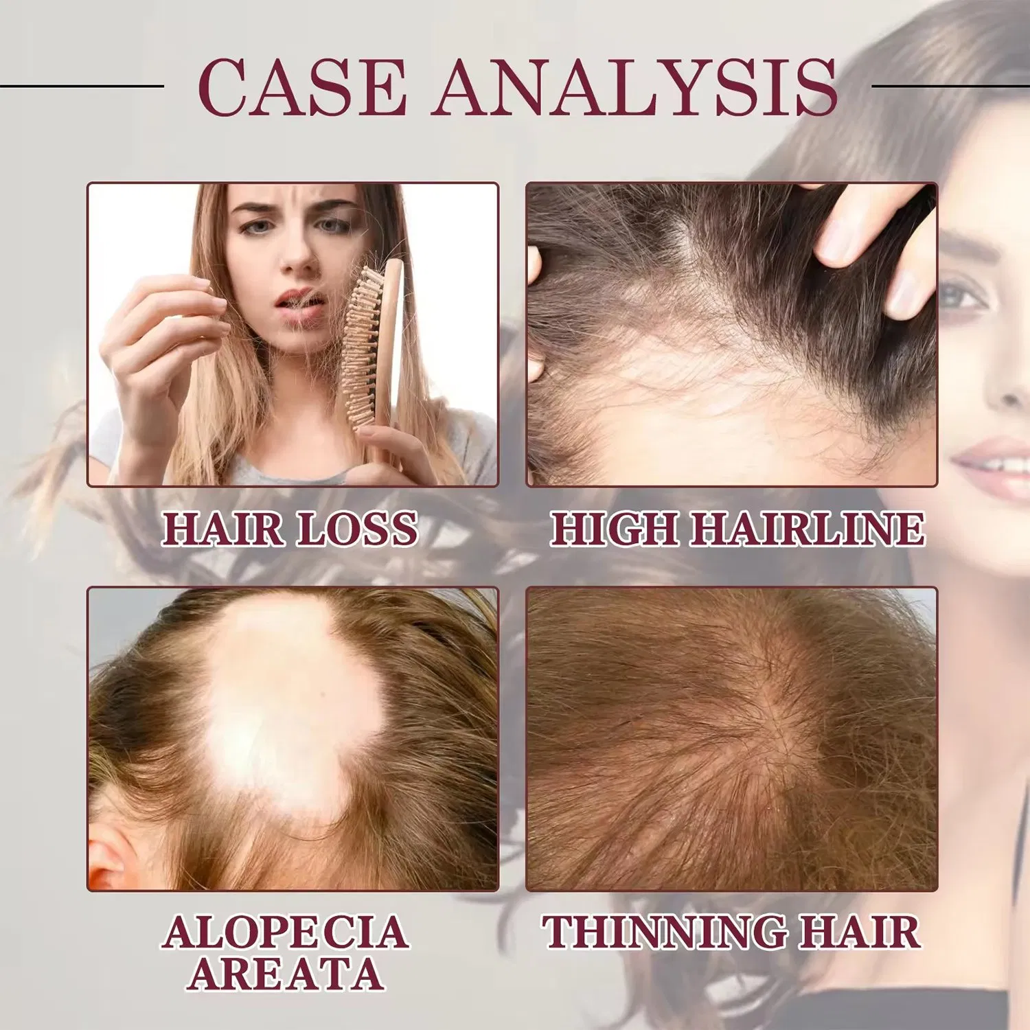 Hot Selling Red Onion Oil Hair Booster Oil