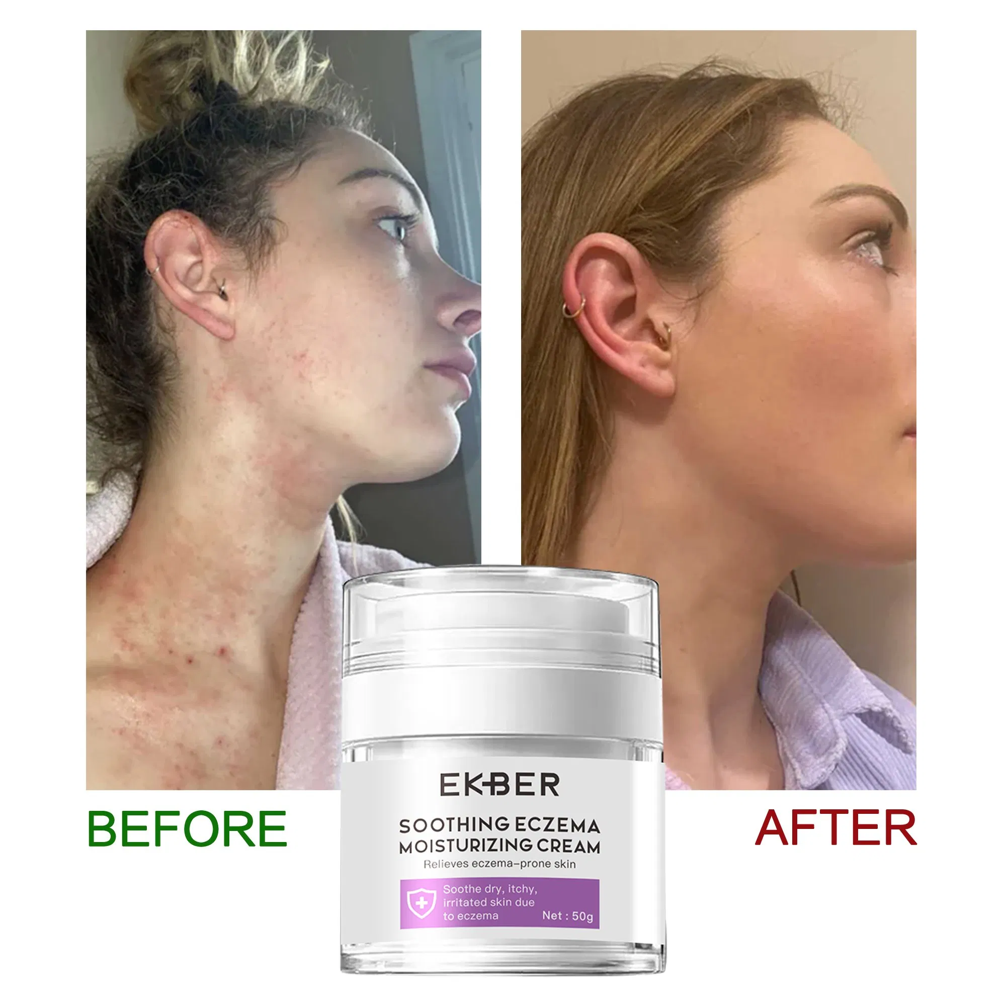Private Label Soothing Eczema Moisturizing Cream Chinese Herbal Moisturizer Relieves Eczema-Prone Skin