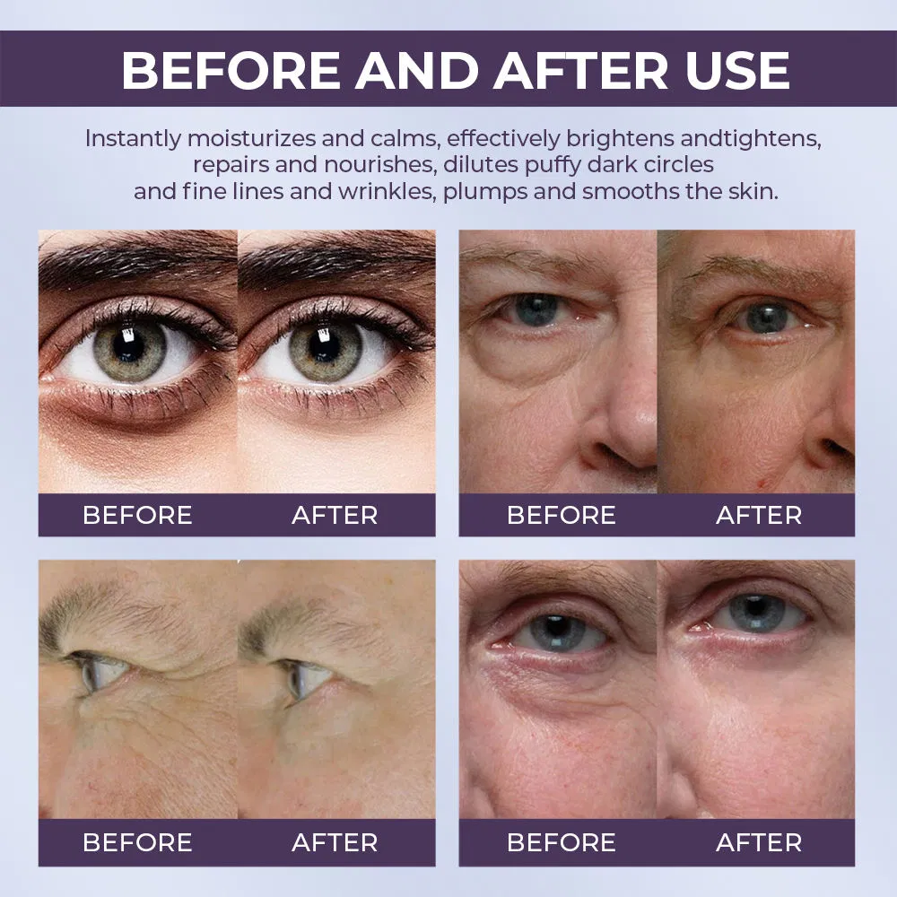 Vegan PRO Retinol Collagen Eye Cream Anti-Wrinkle Firming Repair Skin Remove Cream