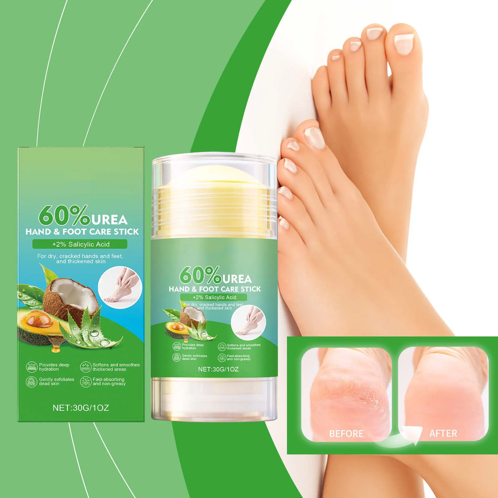 Foot Care 60% Urea Cream Stick Hands Knees Elbows Feet Exfoliating Dead Skin Urea Foot Balm Stick for Dry Cracked Skin