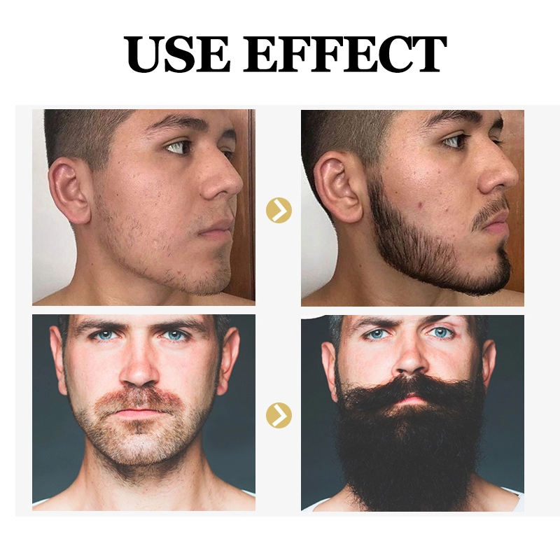 Organic Anti-Hair Loss Moisturizing Smoothing Beard Regrowth Oil