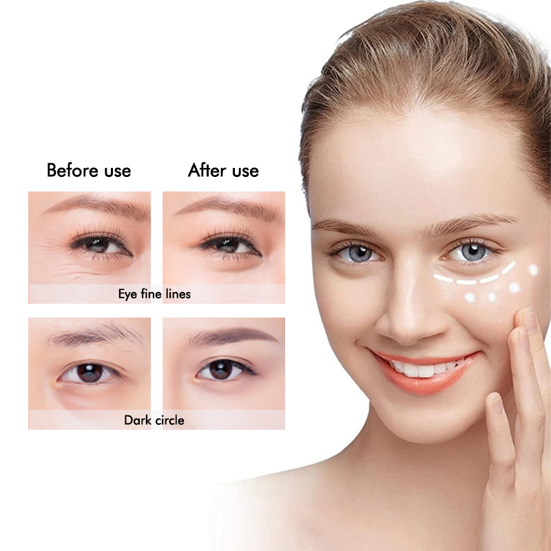 High Quality Black Technology Dark Circle Reduces Wrinkles Moisturizing Eye Cream