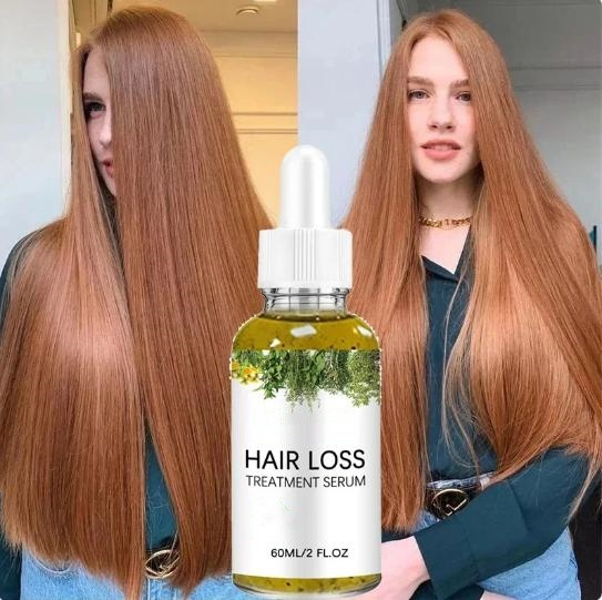 Repairing Hair Cruelty Free Anti Hair Loss Treatment Natural Rosemary Hair Growth Oil Serum