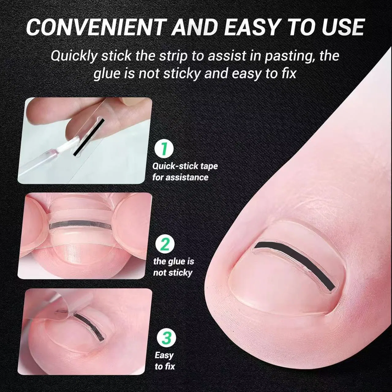 Professional Home Care for Curved Nails Titanium Alloy Ingrown Toenail Treatment