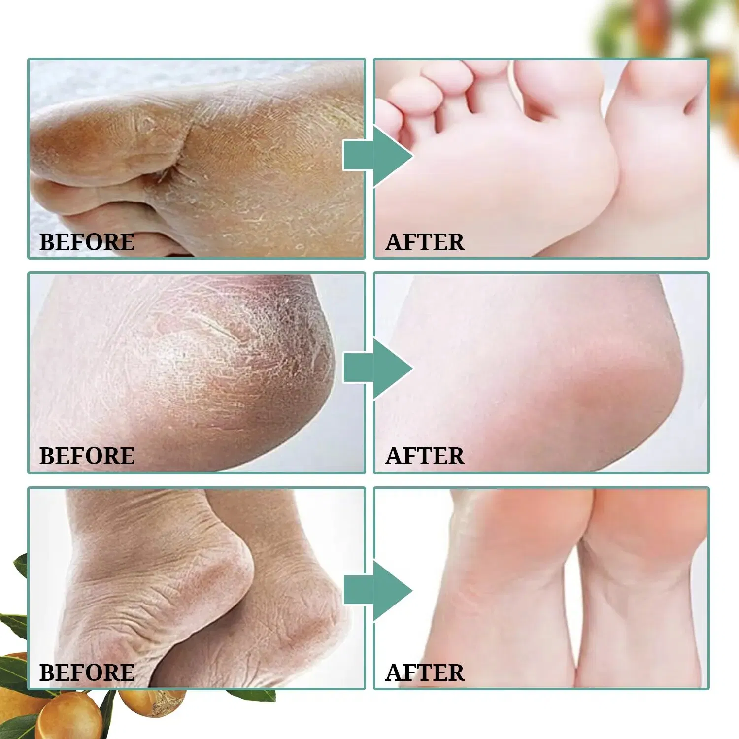 Foot Care Cow Milk Exfoliating Keep Water Foot Mask
