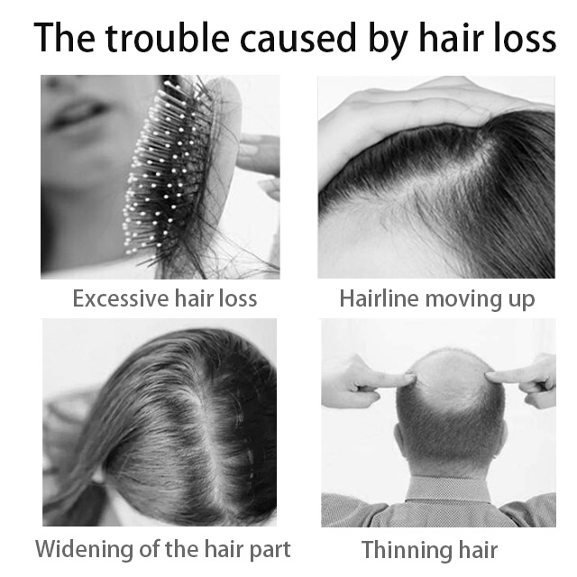 Peptide Hair Density Serum Deep Nourishment for Anti-Hair Loss Scalp Care Natural Hair Regrowth Micro-Infusion Serum