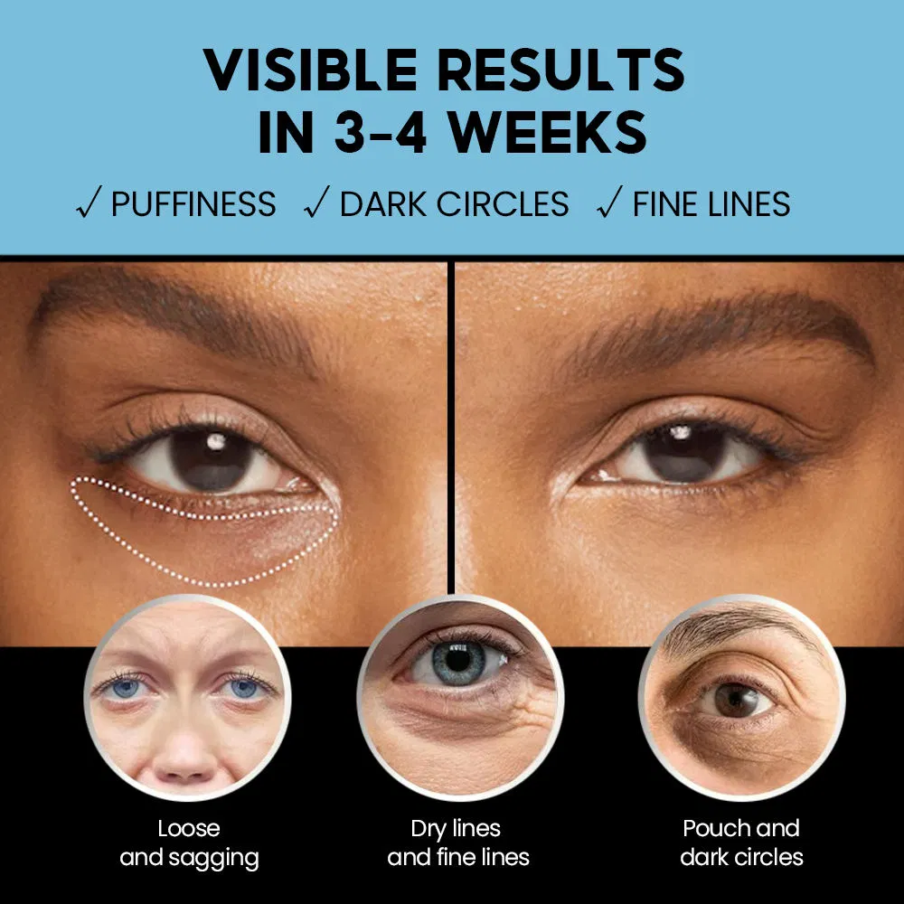 Anti-Wrinkle Eye Cream Hyaluronic Acid Removes Dark Circles Eyebags Nourishing Retinol